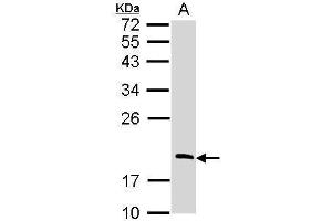 WB Image Sample (30 ug of whole cell lysate) A: Raji 12% SDS PAGE antibody diluted at 1:1000 (RGS13 anticorps)