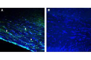 Expression of GPR143 in mouse corpus callosum. (GPR143 anticorps  (Intracellular))