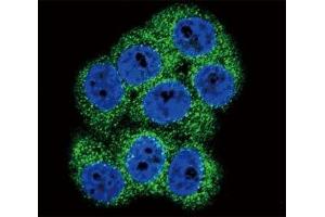 Confocal immunofluorescent analysis of DDR1 antibody with 293 cells followed by Alexa Fluor 488-conjugated goat anti-rabbit lgG (green).