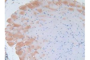 IHC-P analysis of Mouse Skeletal Muscle Tissue, with DAB staining. (IL-2 anticorps  (AA 10-169))