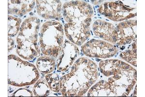 Immunohistochemical staining of paraffin-embedded Human Kidney tissue using anti-TTC32 mouse monoclonal antibody. (TTC32 anticorps)