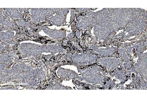 IHC analysis of L/CMBL using anti-L/CMBL antibody (ABIN7599150). (CMBL anticorps  (AA 1-246))