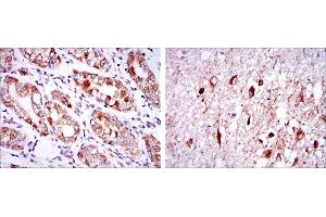 Immunohistochemical analysis of paraffin-embedded stomach tissues (left) and brain tissues (right) using OTX2 mouse mAb with DAB staining. (OTX2 anticorps)