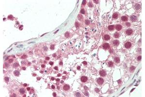 Rabbit Anti-HERC5 antibody  Formalin Fixed Paraffin Embedded Tissue: Human Testis Primary antibody Concentration: 1:100 Secondary Antibody: Donkey anti-Rabbit-Cy3 Secondary Antibody Concentration: 1:200 Magnification: 20x Exposure Time: 0.