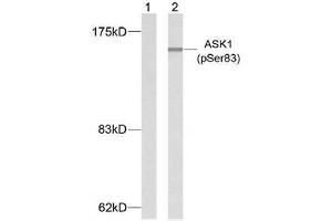 Western blot analysis of extracts from K562 cells using ASK1 (phospho-Ser83) antibody (E011178). (ASK1 anticorps  (pSer83))