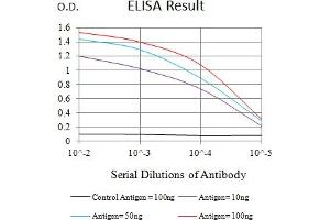 Black line: Control Antigen (100 ng),Purple line: Antigen (10 ng), Blue line: Antigen (50 ng), Red line:Antigen (100 ng)