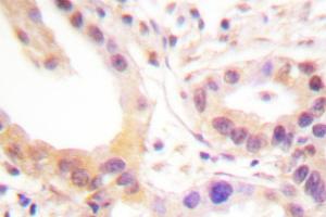 Image no. 1 for anti-V-Ets erythroblastosis Virus E26 Oncogene Homolog 1 (Avian) (ETS1) antibody (ABIN272023) (ETS1 anticorps)