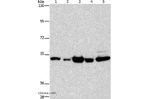 Western blot analysis of Human bladder carcinoma and brain malignant glioma tissue, A172 cell, human fetal brain tissue and hela cell, using PDE4D Polyclonal Antibody at dilution of 1:450