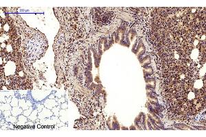 Immunohistochemical analysis of paraffin-embedded rat lung tissue. (Cadherin 5 anticorps  (Internal Region))