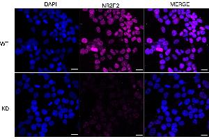 Immunocytochemical staining of HeLa cells using NR2F2 antibody (ABIN7799656), 1:1,000), Top panel: wild-type (WT), Bottom panal: NR2F2 shRNA knockdown (KD).