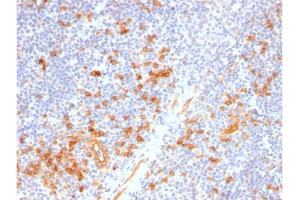 Formalin-fixed, paraffin-embedded human Tonsil stained with IL3RA / CD123 Rabbit Recombinant Monoclonal Antibody (IL3RA/2947R). (Recombinant IL3RA anticorps  (AA 26-171))