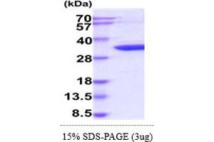 SDS-PAGE (SDS) image for Cyclin-Dependent Kinase 5 (CDK5) (AA 1-292) protein (His tag) (ABIN5855017)