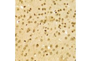 Immunohistochemistry of paraffin-embedded mouse brain using DKC1 Antibody (ABIN5970956) at dilution of 1/100 (40x lens). (DKC1 anticorps)