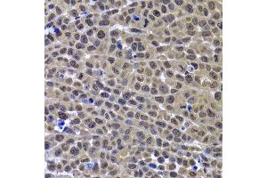 Immunohistochemistry of paraffin-embedded mouse cancer using GPS1 antibody at dilution of 1:100 (x400 lens). (GPS1 anticorps)
