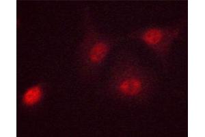 ABIN6267271 staining HeLa cells treated with Forskolin 40nM 30' by ICC/IF.