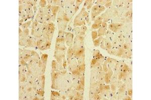 Immunohistochemistry of paraffin-embedded human heart tissue using ABIN7145063 at dilution of 1:100