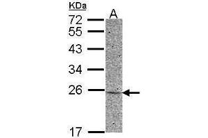 WB Image Sample (30 ug of whole cell lysate) A: HCT116 12% SDS PAGE antibody diluted at 1:500 (Adenylate Kinase 1 anticorps)