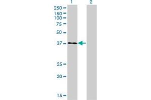 Western Blot analysis of USF1 expression in transfected 293T cell line by USF1 monoclonal antibody (M01), clone 3F6. (USF1 anticorps  (AA 1-310))