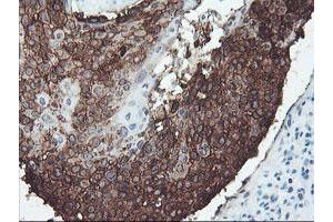 Image no. 7 for anti-Signal Recognition Particle Receptor, B Subunit (SRPRB) antibody (ABIN1501126)