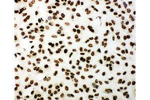 Anti-53BP1 antibody, ICC ICC: A549 Cell