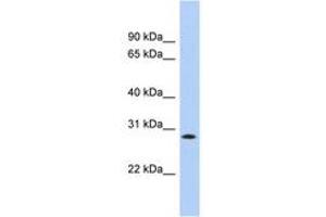 Image no. 1 for anti-Potassium Channel Tetramerisation Domain Containing 17 (KCTD17) (AA 179-228) antibody (ABIN6742565) (KCTD17 anticorps  (AA 179-228))