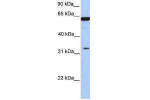 PERLD1 antibody used at 1 ug/ml to detect target protein. (PGAP3 anticorps  (N-Term))