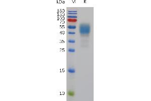 Mouse CB1 Protein, hFc Tag on SDS-PAGE under reducing condition.