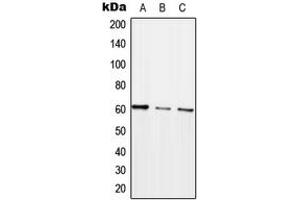 Western blot analysis of ARHGEF5 expression in HEK293T (A), SP2/0 (B), H9C2 (C) whole cell lysates. (ARHGEF5 anticorps  (Center))