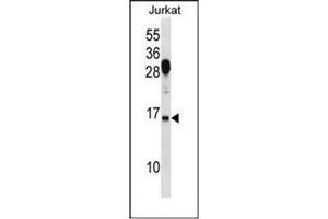 Western blot analysis of RhoG Antibody (C-term) in Jurkat cell line lysates (35ug/lane).