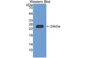 Western blot analysis of the recombinant protein. (NCF2 anticorps  (AA 355-526))