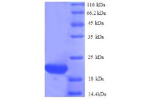 SDS-PAGE (SDS) image for ISG15 Ubiquitin-Like Modifier (ISG15) (AA 2-157) protein (His tag) (ABIN5712704)