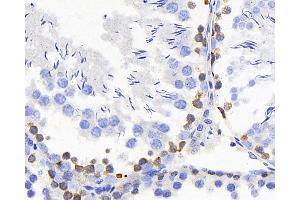 Immunohistochemistry analysis of paraffin-embedded rat testis using TSC22D3 Polyclonal Antibody at dilution of 1:300. (TSC22D3 anticorps)