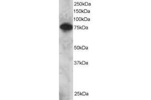Image no. 1 for anti-SET Domain and Mariner Transposase Fusion Gene (SETMAR) (AA 671-684) antibody (ABIN297642) (SETMAR anticorps  (AA 671-684))
