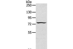 Western Blot analysis of Jurkat cell using TAP2 Polyclonal Antibody at dilution of 1:200 (TAP2 anticorps)