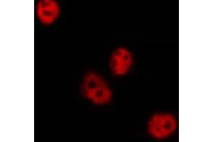 ABIN6267399 staining HeLa by IF/ICC. (CREB1 anticorps  (pSer142))