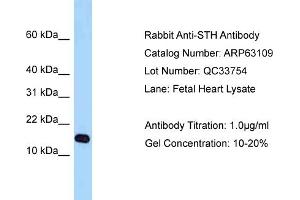 Western Blotting (WB) image for anti-Saitohin (STH) (Middle Region) antibody (ABIN2789376)