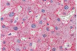 Human Liver: Formalin-Fixed, Paraffin-Embedded (FFPE) (CDC16 anticorps  (N-Term))