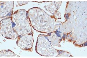 Immunohistochemistry of paraffin-embedded Human placenta using PDGFR beta Polyclonal Antibody at dilution of 1:100 (40x lens). (PDGFRB anticorps)