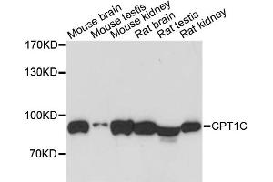 Western blot analysis of extracts of various cell lines, using CPT1C antibody. (CPT1C anticorps)