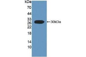 Detection of Recombinant FcaR, Rat using Polyclonal Antibody to Fc Fragment Of IgA Receptor (FcaR) (FCAR anticorps  (AA 51-280))