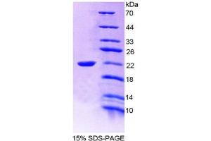 SDS-PAGE of Protein Standard from the Kit  (Highly purified E.