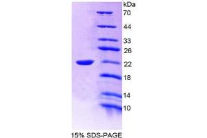 SDS-PAGE of Protein Standard from the Kit  (Highly purified E. (IL-19 Kit ELISA)