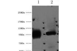 Western Blot analysis of 1) Hela, 2) 293T cells using ABCB5 Monoclonal Antibody at dilution of 1:2000. (ABCB5 anticorps)