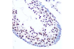 Immunohistochemistry of paraffin-embedded mouse testis using SRSF7 Rabbit pAb (ABIN7270548) at dilution of 1:100 (40x lens). (SFRS7 anticorps  (AA 60-120))