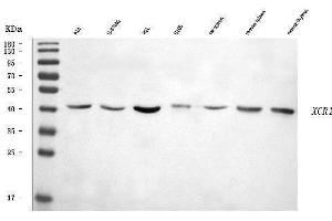 Western blot analysis of CCXCR1/XCR1 using anti-CCXCR1/XCR1 antibody (ABIN7600872).