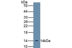 Detection of Recombinant CFB, Mouse using Polyclonal Antibody to Complement Factor B (CFB) (Complement Factor B anticorps  (AA 32-157))