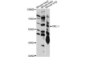 Western blot analysis of extracts of various cell lines, using CBLL1 antibody (ABIN6292394) at 1:1000 dilution. (CBLL1 anticorps)