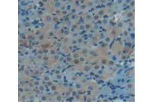 IHC-P analysis of Human Tissue, with DAB staining. (Aconitase 1 anticorps  (AA 26-243))