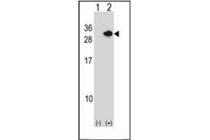 Western blot analysis of RCAN1 (arrow) using Calcipressin-1 Antibody .