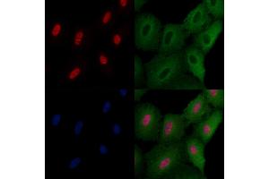 ABIN6258629 and ABIN6275742 staining  cells by IF/ICC. (Elf4 anticorps  (Internal Region))